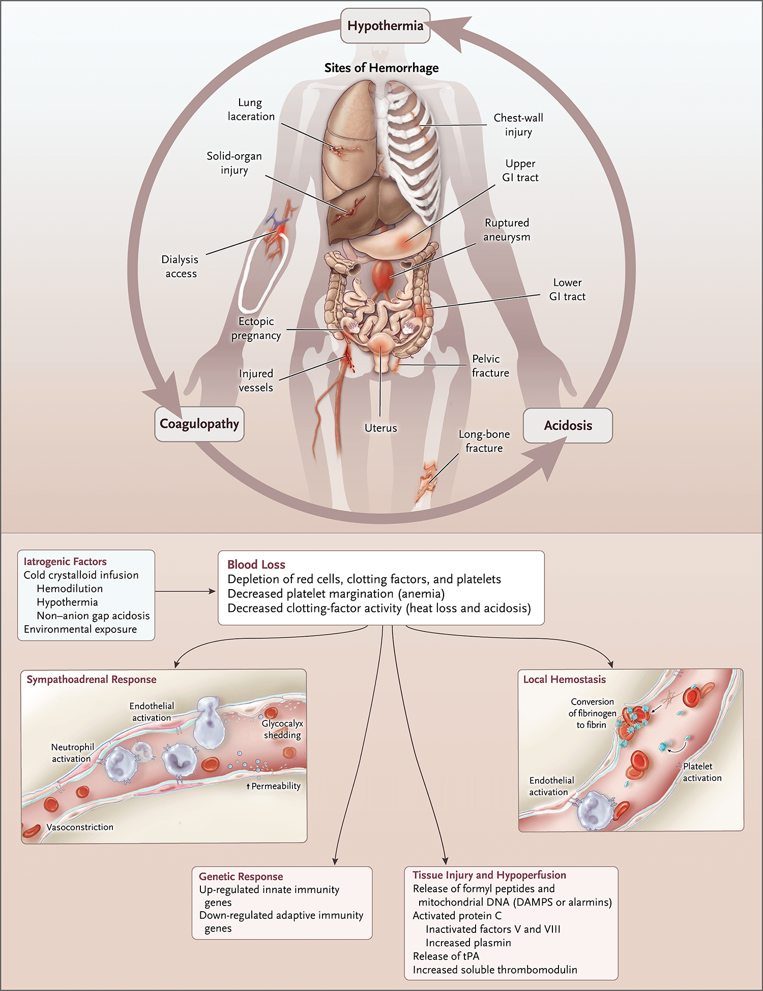  NEJM 