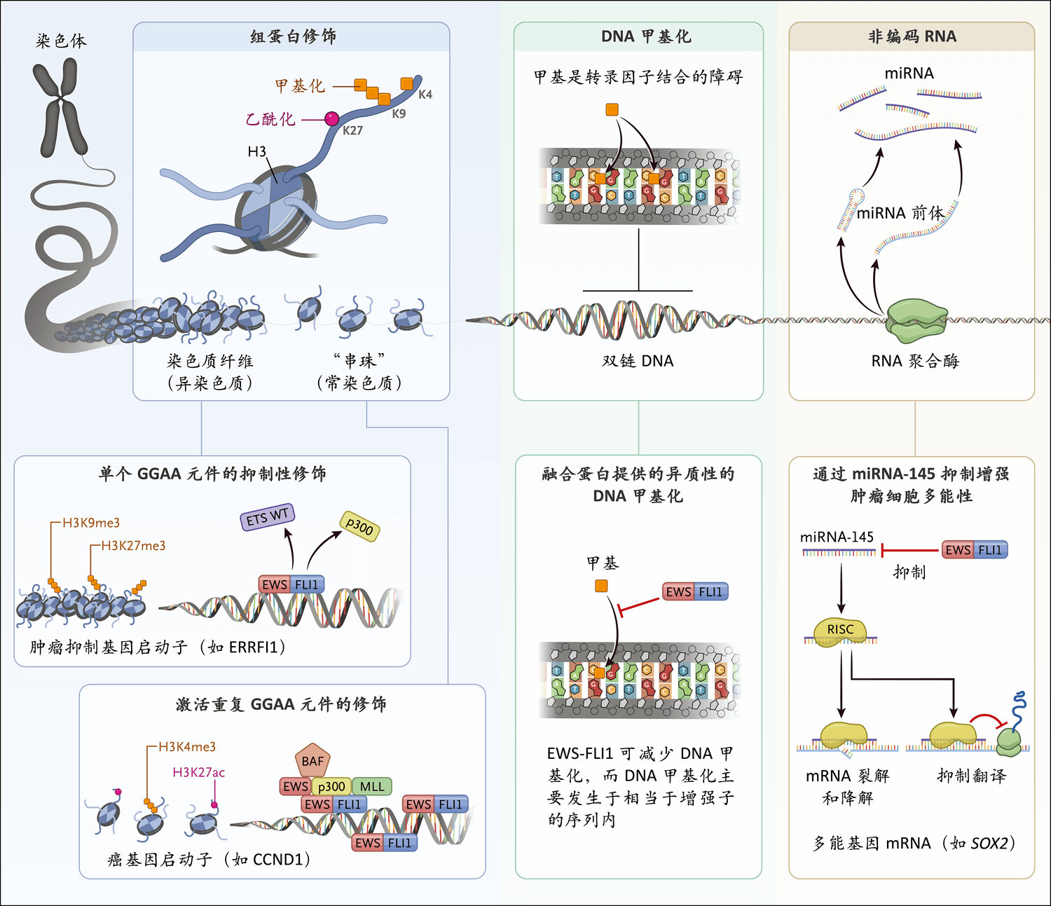 尤因肉瘤 Nejm医学前沿