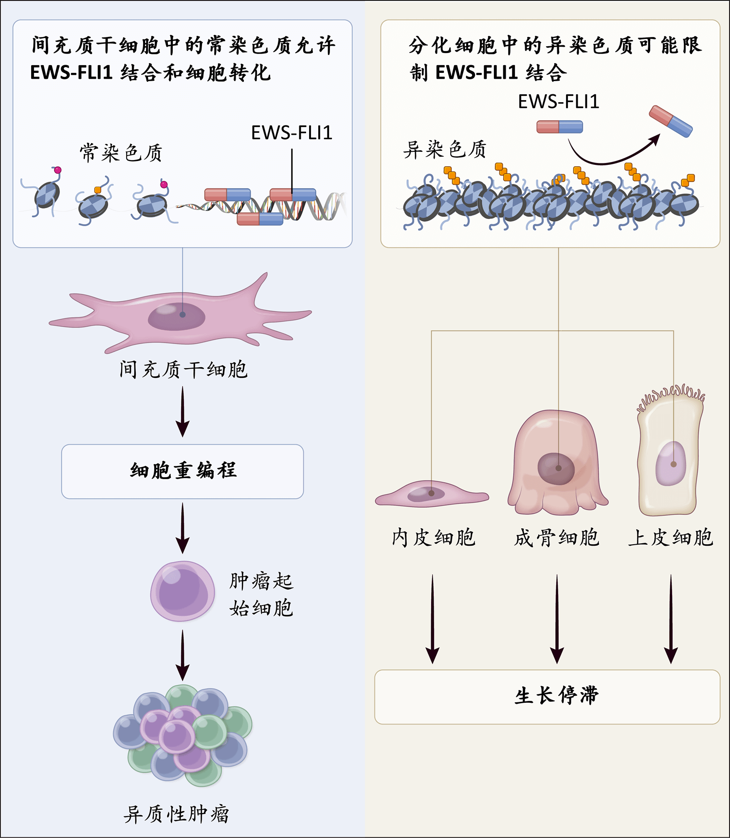 尤因肉瘤 Nejm医学前沿 尤因肉瘤 Nejm医学前沿