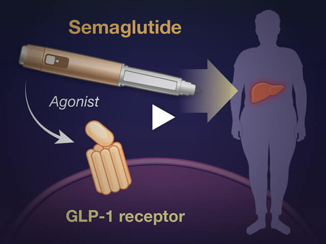 glp 1 nejm NEJM医学前沿